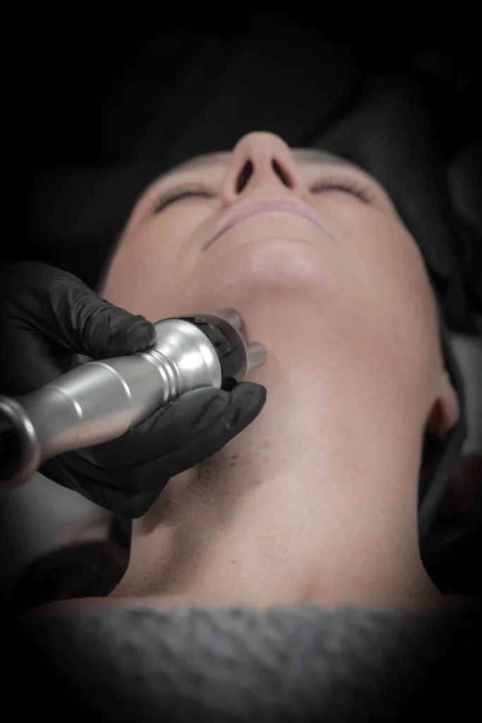 The High-Tech Way to Get a Lifted Look Without Going Under the Knife