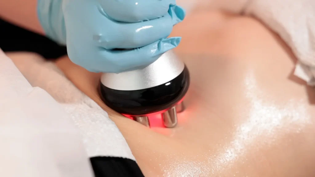 Does Laser Lipo Really Work? What Science Says