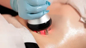 Does Laser Lipo Really Work?