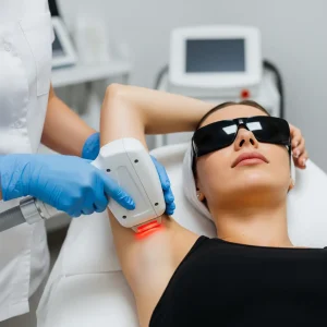 Laser Hair Removal in Calgary