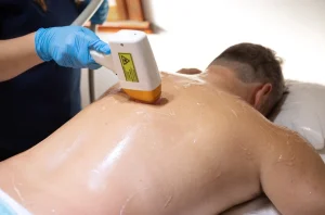full back laser hair removal