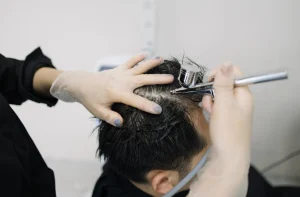 Scalp treatment using airbrush technique at You Glow Aesthetics