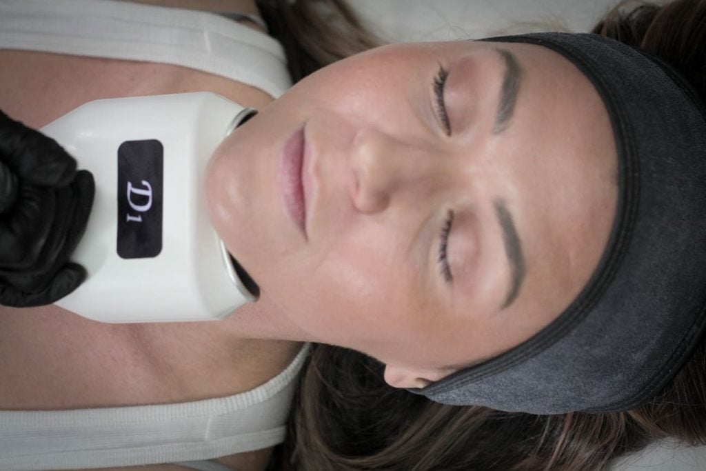 Double Chin Removal