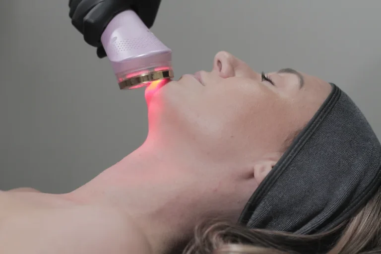 Red Light Therapy Treatments in Calgary NW