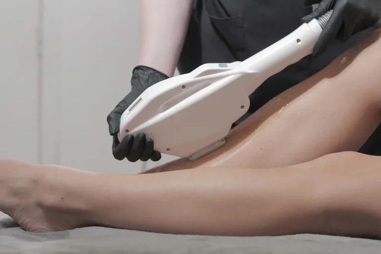 Laser Hair Removal Treatments in Red Deer