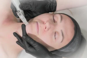 using a dermapen to rejuvenate and improve skin texture.