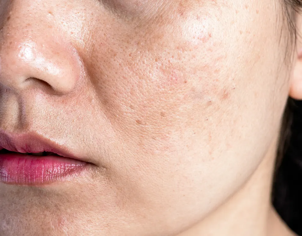 skin concern- Pigmentation and Skin Tone Balance
