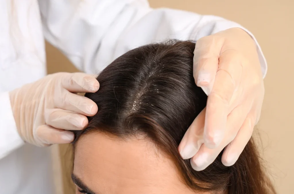 skin concern- Scalp Health & Dandruff