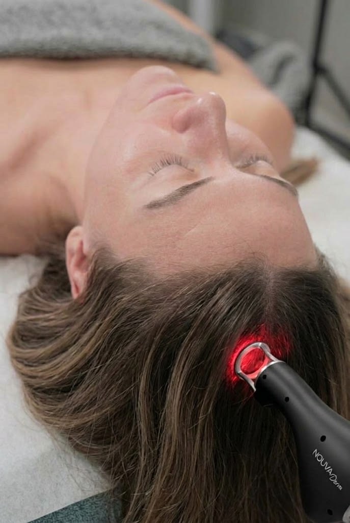 NOUVADerm scalp treatment for hair restoration at You Glow Aesthetics Vancouver