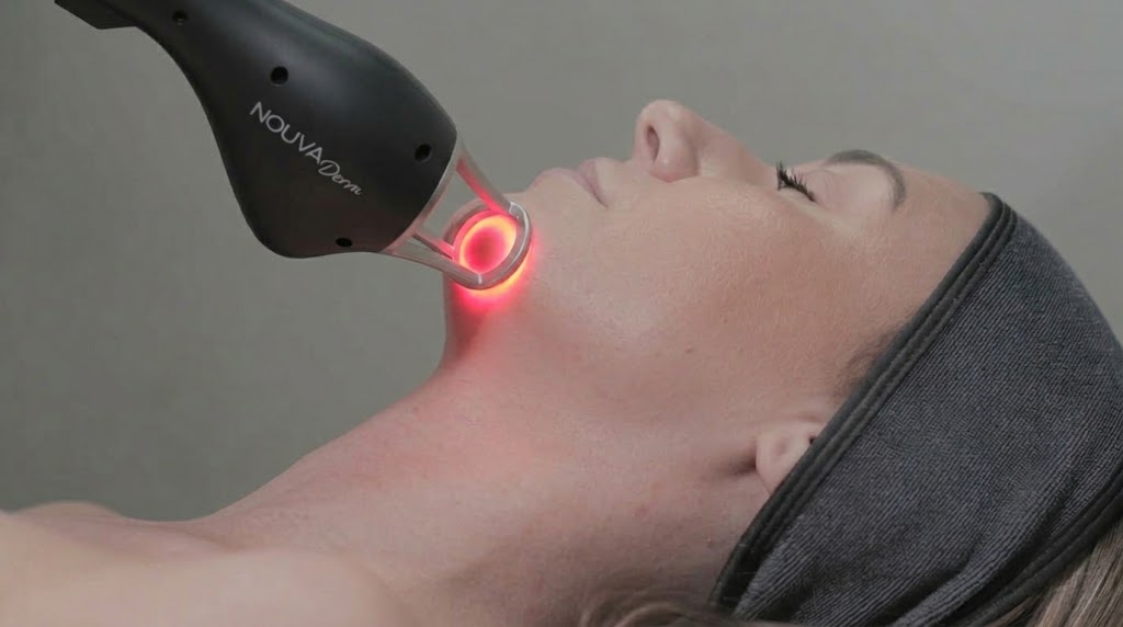 Laser skin resurfacing treatment with the NOUVADerm handpiece at You Glow Aesthetics Vancouver